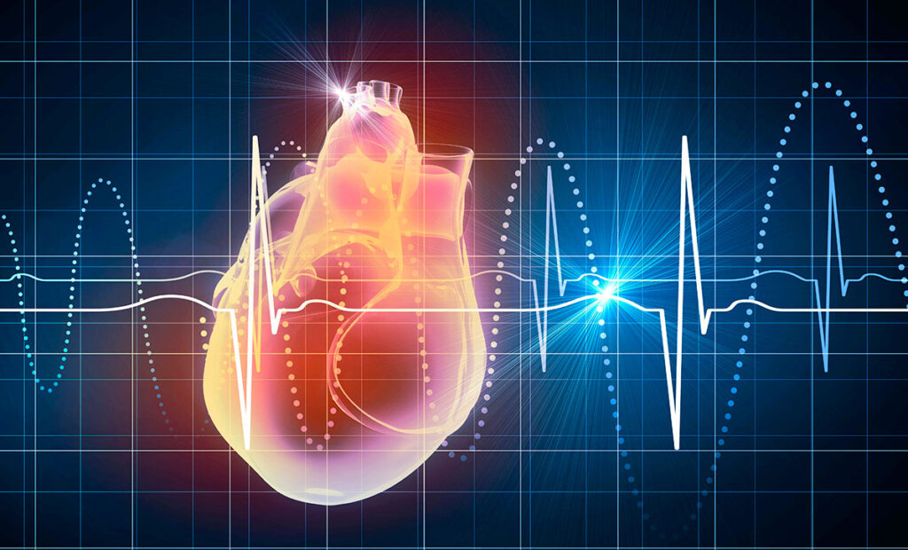 electrocardiograma ecg